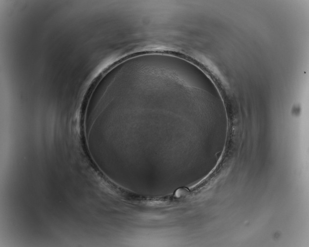 X0000102861173200808181434