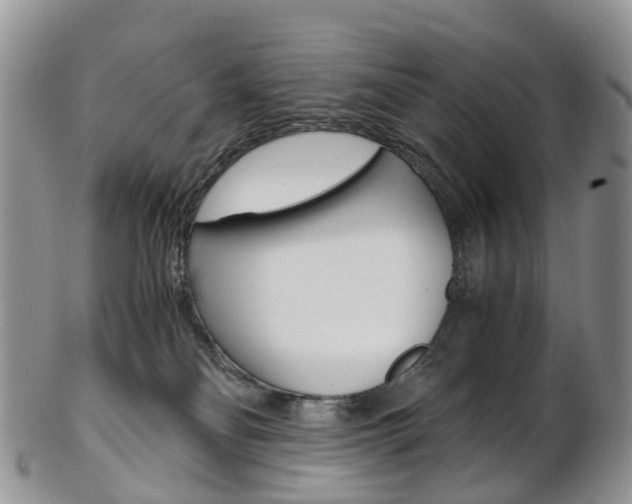 X0000103140134200808221113