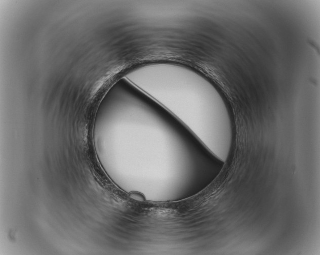 X0000103140539200808221106