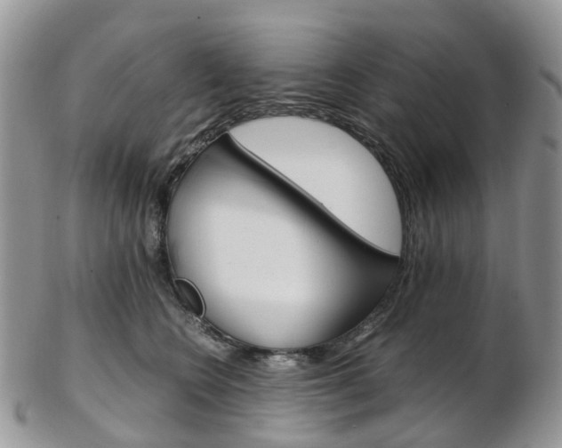 X0000103140566200808221107