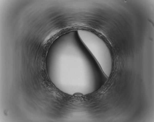 X0000103140919200808221101