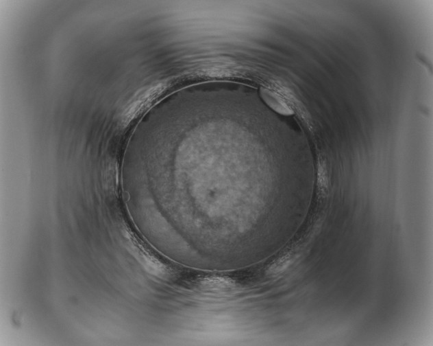 X0000103140397200808221220