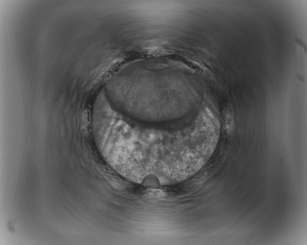 X0000103140519200809051617