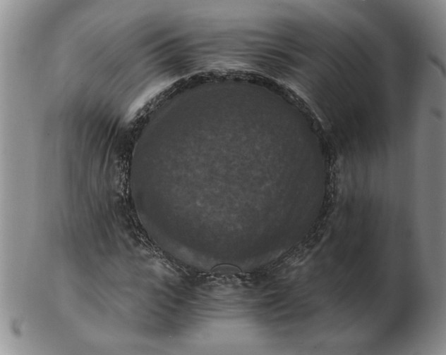 X0000103140919200809051611