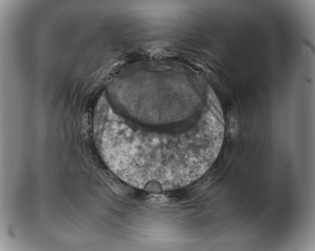 X0000103140519200809121757