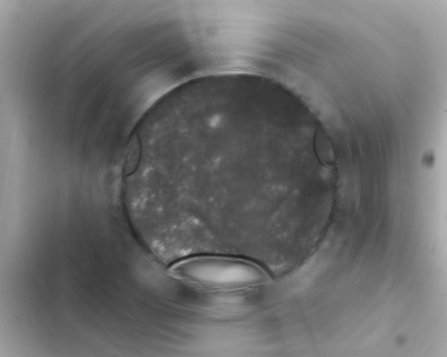 X0000103151457200809192017