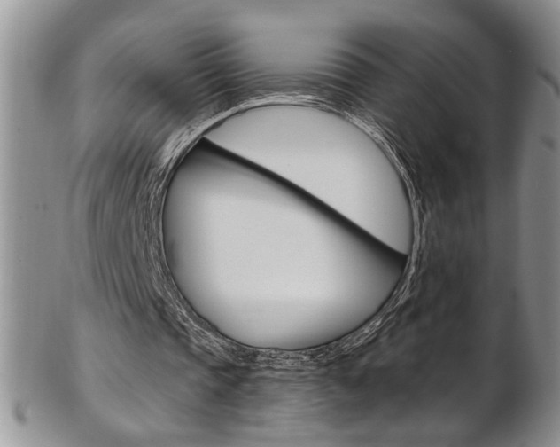 X0000103170337200808221133