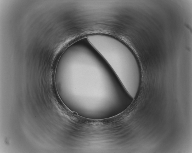 X0000103170395200808221133