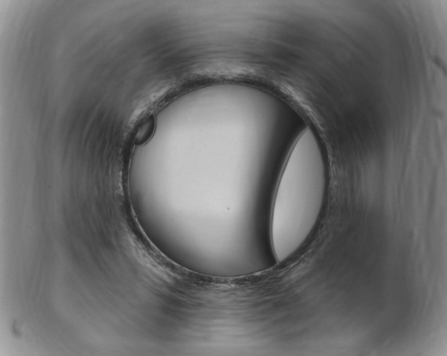 X0000103170399200808221133