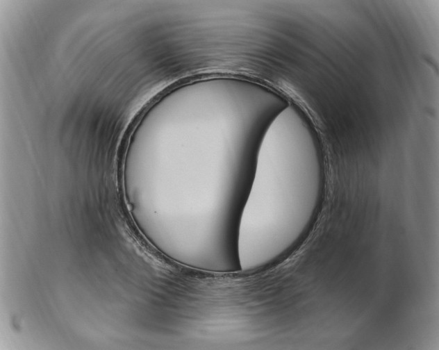 X0000103170884200808221125