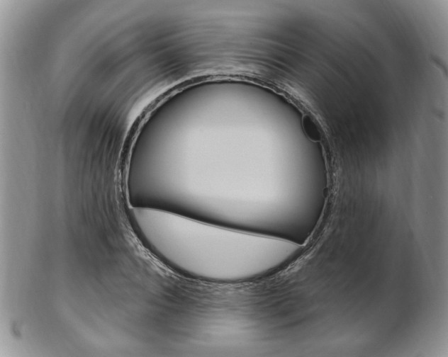 X0000103170928200808221125