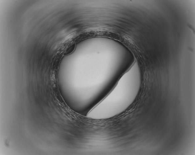 X0000103171062200808221123