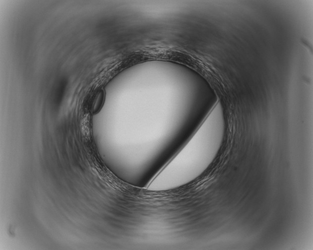 X0000103171156200808221122