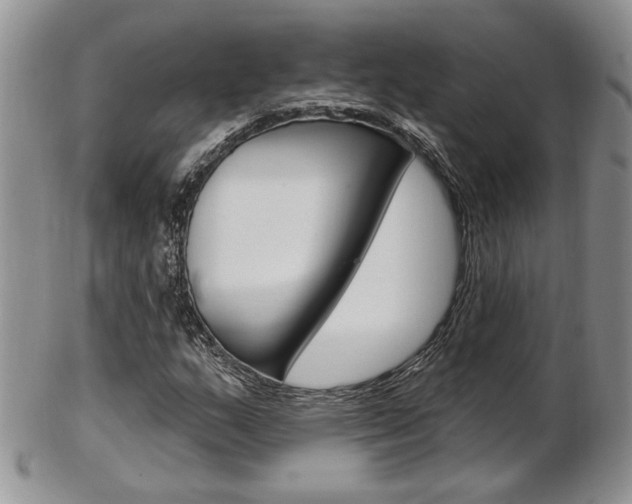 X0000103171159200808221122
