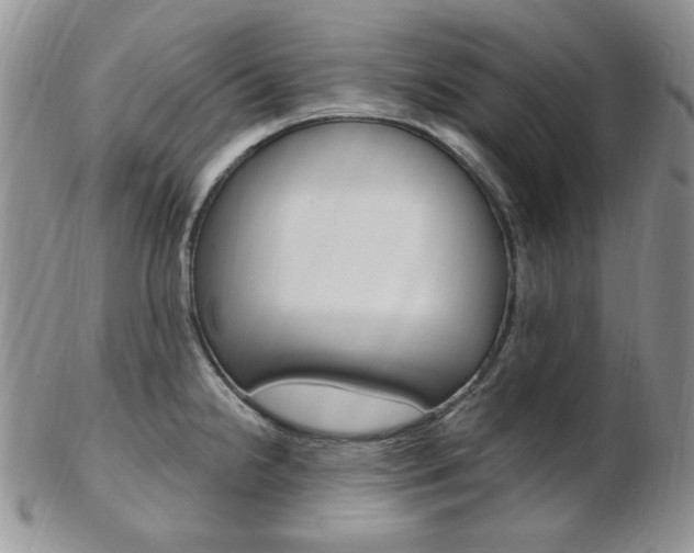 X0000103171238200808221121