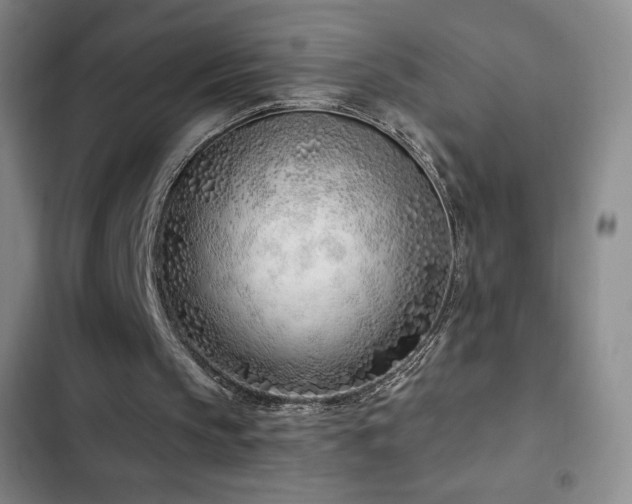 X0000103170145200808221243