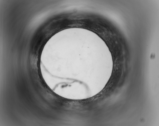 X0000103170146200808221243