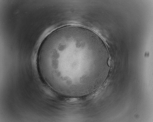 X0000103170151200808221243