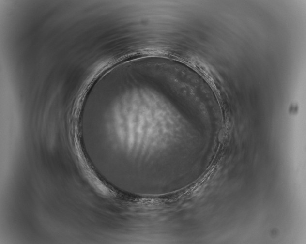 X0000103220145200808281415