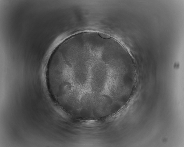 X0000103220151200808281415