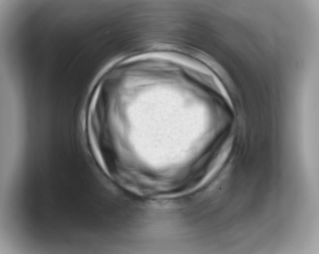 X0000103241198200809181538