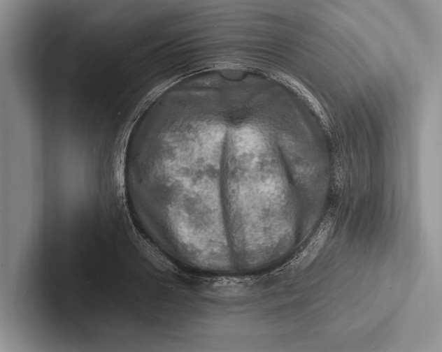 X0000103250938200809111612