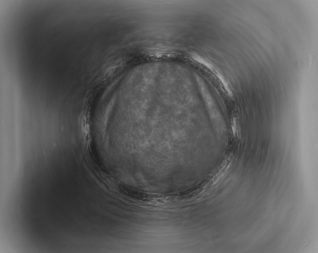 X0000103251396200809111605