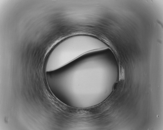 X0000103300387200808291135