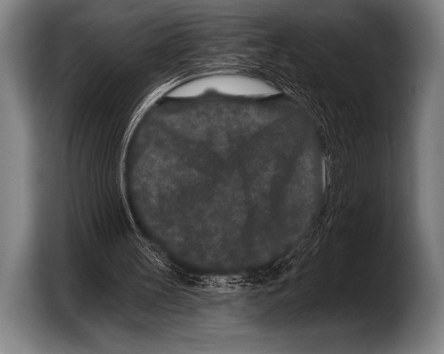 X0000103320147200810061001
