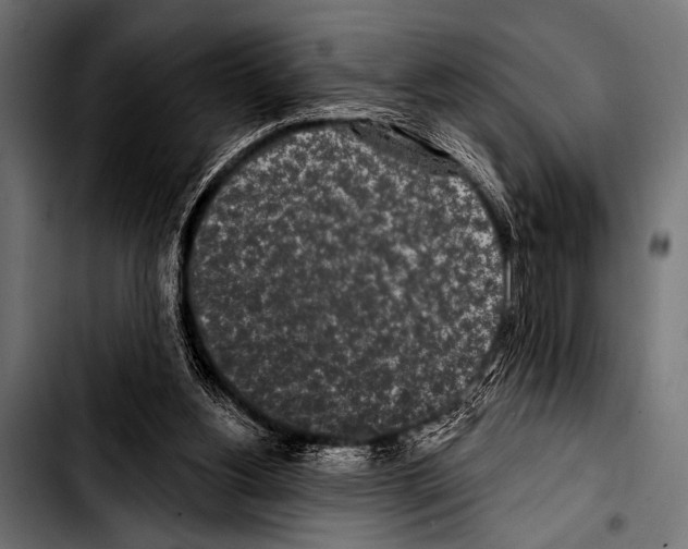 X0000103320156200810171409