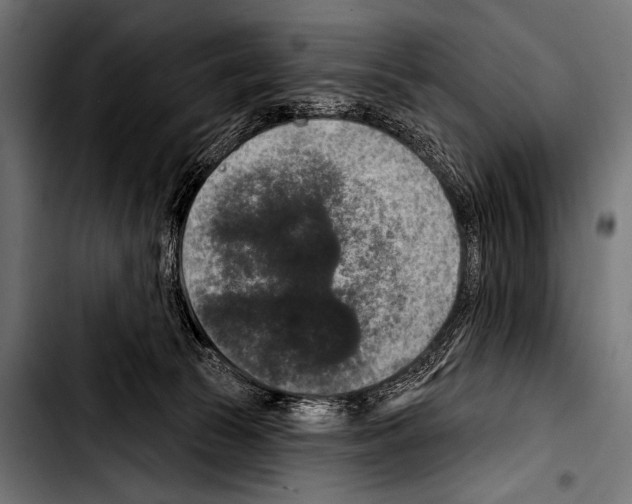 X0000103320177200810171410