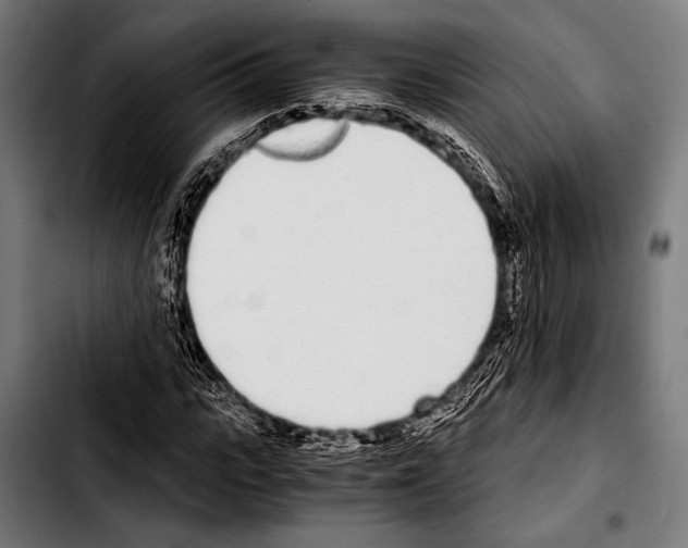 X0000103330919200810171420