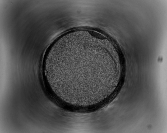 X0000103400196200810100941