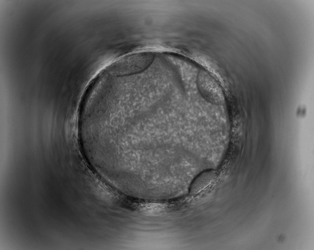 X0000103431173200810101035