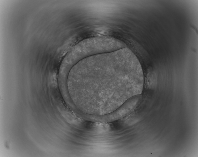X0000103470520200810241017