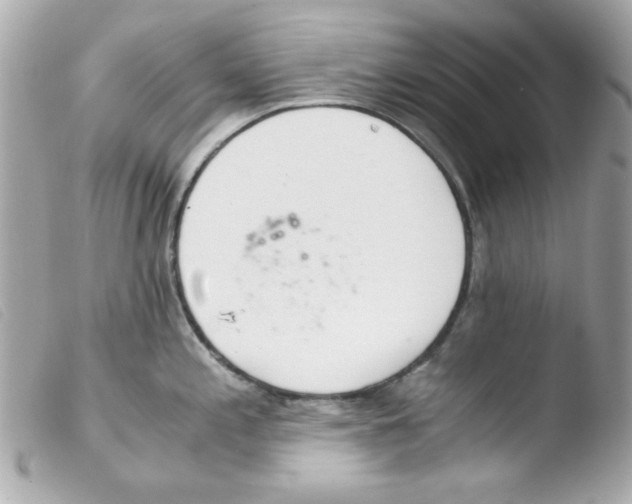 X0000103501197200810101039