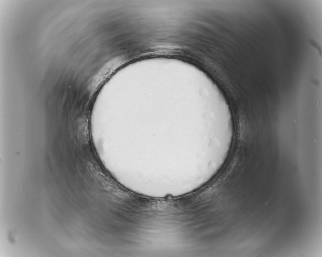 X0000103501362200810101036