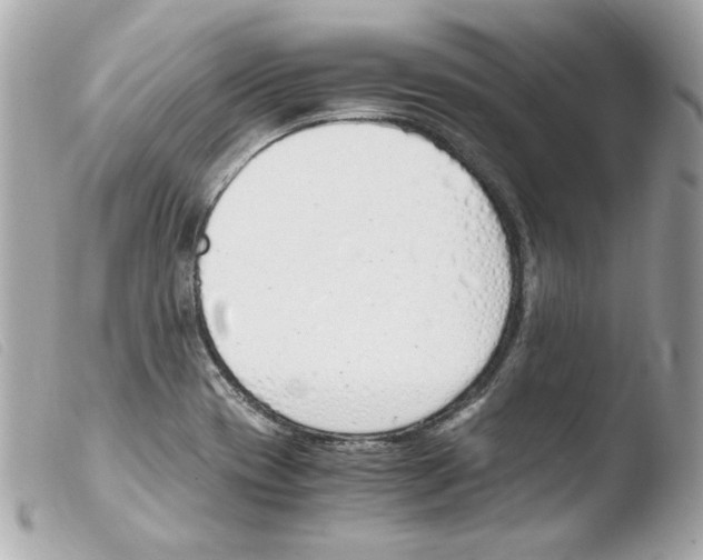 X0000103501417200810101036