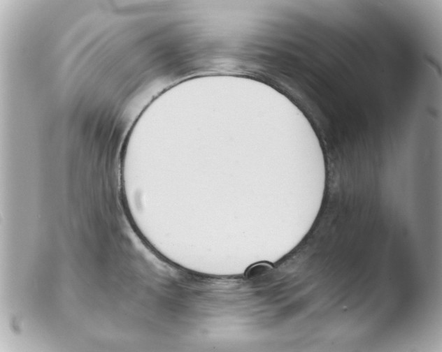 X0000103501479200810101035