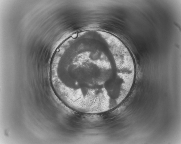 X0000103900957200810031146