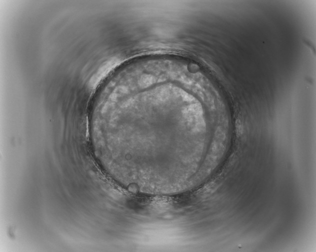 X0000103901267200810031140