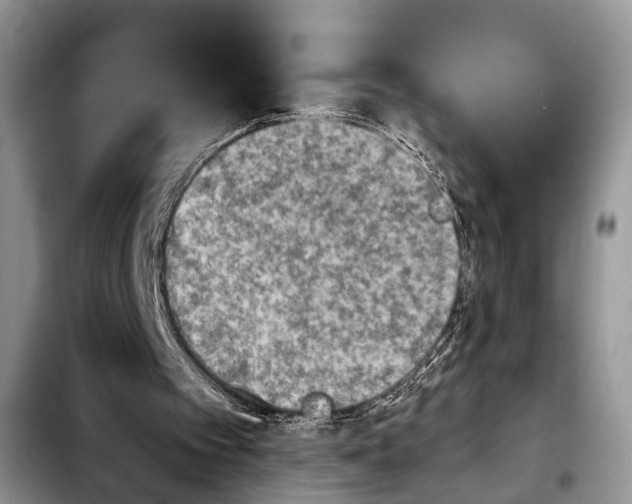 X0000103900097200810101254