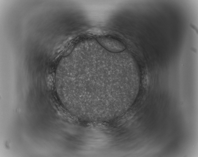 X0000103911397200810171654