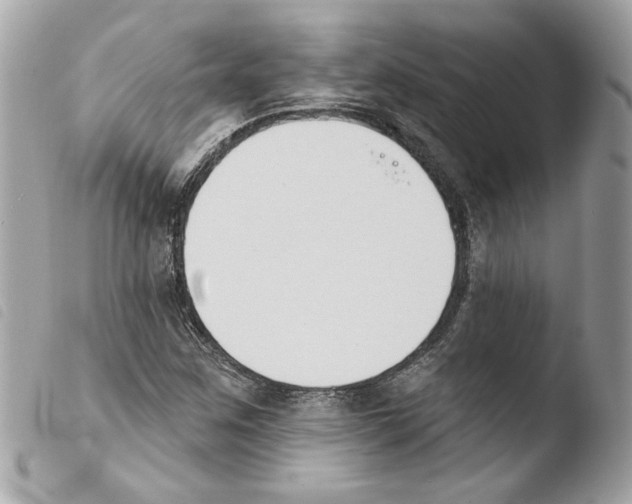 X0000103931259200810171743