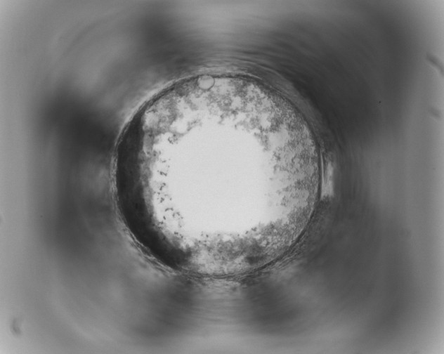 X0000103940387200810171820