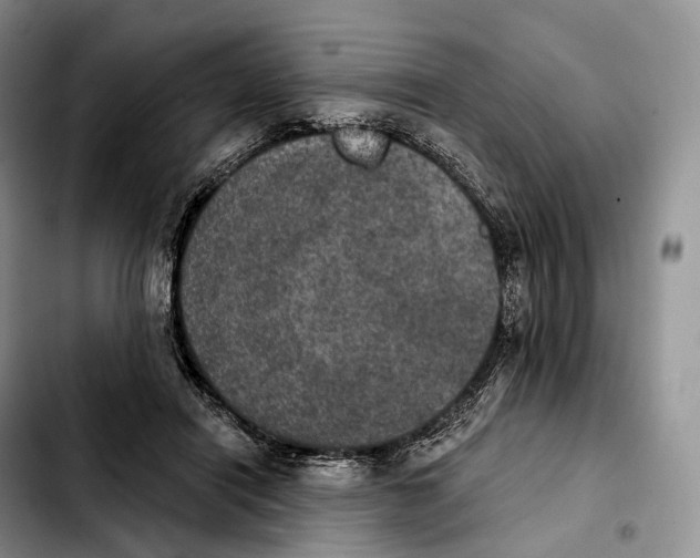 X0000103950454200810101442