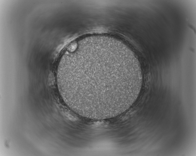 X0000103951160200810171831
