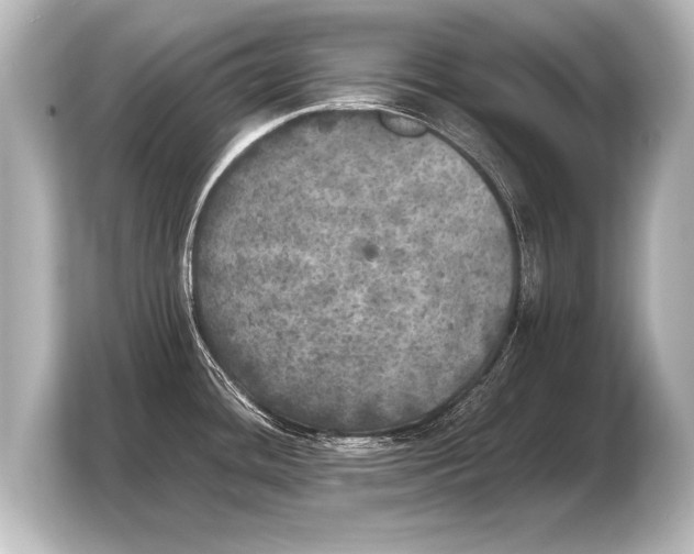 X0000103961436200810031155