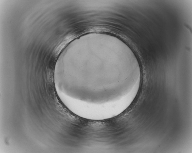 X0000103960945200810171859