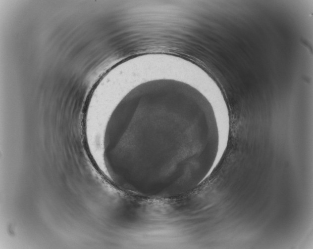 X0000103960995200810171858